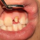 이지치과기공소 이미지