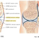 관절에 생기는 질환은 어떤 것들이 있을까? 이미지
