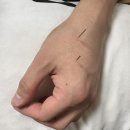 20235522 이수민 의안과제(2) 이미지