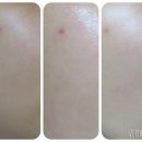 피부홈케어 mts만한 게 없어요 (1일1팩업글버전)