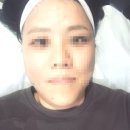 대명약국 | 대구피부관리샵 울써마지 대명동여성리프팅 추천 뷰티J메디스킨랩