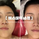 해운대소방서 | 해운대 마린시티 에스테틱 30년 경력! 에스테틱 소정 얼굴축소관리 후기