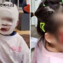 "3살 딸 얼굴 죄다 갈렸다" 놀이기구 전복사고 '경악' 이미지