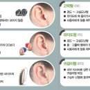 시그니아독일보청기함양센터