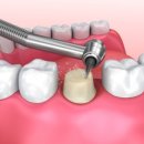 탑티어치과의원 이미지