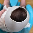 대호보조기상사 | 사두증 진단받고 헬멧 제작하고 온 후기 -2편