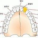 468회 티아라(지연), 보라색 칫솔, 엄마 앞니 이미지