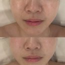 레메디 | 신도림 호텔식 에스테틱 무너진 피부 장벽 LDM 케어 받은 후기, '엘뷰티 레메디'