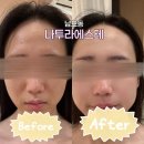 나투라 | 부산 남포동 피부관리 나투라에스테, 본식 앞두고 웨딩케어 받은 후기