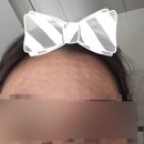 타토아의원 | [웨딩 준비] 예비 신부가 하는 피부 관리들💍👸(feat. 리쥬란 후기, 원주 타토아의원)