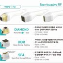 샤인ITC | [포텐자] 셀프 시술 후기