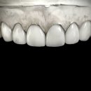 더블유치과기공소 이미지