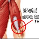 디클리셰 이미지