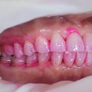 바이오크리닝 이미지