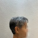 미래가발 | 맞춤가발 처음이라면? 탈모 유형별 맞춤가발 선택 A부터 Z까지