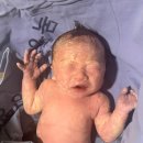 건강한세상약국 | [출산후기] 목동제일여성병원 제왕절개 당일_후기, 타임라인, 통증, 운동(2/28)