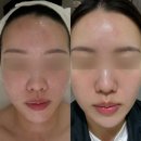 신명여자중학교 | 대구 수성구 피부관리 온리수 에스테틱 여드름피부 모낭염피부도 촉촉할 수 있어요