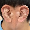 이혈(귀) 상담과 건강관리 | [디그니파이]귀상담지도사 1급 자격증 취득 | 자연...주는 귀 건강법 | 내가 직접 효과를 본 이혈테라피...