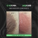디어케어