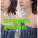 GS25백양뜨란채 | 부산 당감동 페이스 윤곽관리 웨딩관리 승모 관리 맛집 에르모아