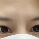 브로우리즈 이미지