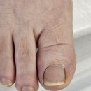 경상북도교육청성주도서관 | 성주 예산 발 각질케어 내성발톱 관리 전문점 뷰티NB 성주점