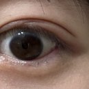 향남밝은안과의원 이미지