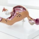 정자센트럴산부인과의원 네이버블로그