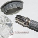 튼튼내이사랑치과의원 이미지