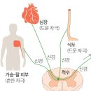 건강한당신&#34;연관통&#34; 이미지