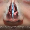뉴진성형외과 이미지