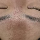 하로스파 | 수유 피부관리 추천! 탄력 &amp; 피부장벽 강화에 딱 좋은 하로스파 방문 후기