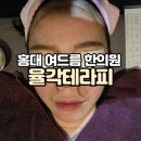 홍대 여드름 한의원 율각테라피 약초침 새살침 후기