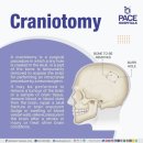 에이치앤메디 | Craniotomy: Type of Brain hemorrhage 뇌출혈의 종류와 두개절골술