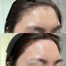 솔헤어라인
