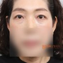 에스에이치(SH)성형외과의원 네이버블로그