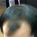 명품가발 네이버블로그
