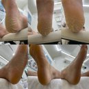 경기도 수원시 권선구 덕영대로1142번길 23-17 (세류동) | 수원 세류동 발각질 뒤꿈치 각질 때문에 고민이라면 코지네일 오벨리네일푸스 족보있는그녀들 수원역점