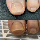 네일플러스 이미지