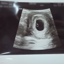 안산튼튼병원 | [6주차~7주차 초음파 기록👶] 폭풍 성장한 아기집과 난황 확인! (+입덧약 처방, 안산 한빛여성병원 후기)
