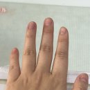 강남 네일샵 아크릴네일 주네일 청담 / 물어뜯는 손톱 연장받은 후기
