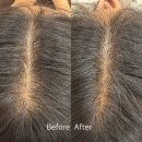 더 타이어샵 해운대좌동점 | 해운대 좌동두피관리 두피관리로 리프팅 피부관리까지 1석3조 예뻐졌다 후기💡