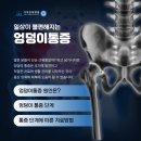 엉덩이통증, 그냥 근육통일까? 원인과 치료 단계 정리 이미지