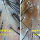 주식회사 비엔티