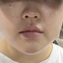 아느크 에스테틱 네이버블로그