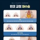 윌성형외과