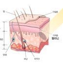 블리스의원 이미지