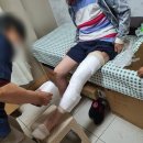 금산정형외과의원 | 어머니 무릎 골절 기브스 후기 _ 금산 정형외과 의원