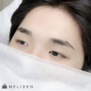 멜리니즈 이미지