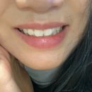 프랜드정치과의원 | [강남 | 신사] 신사역 치아미백 이 시리지 않은 ‘레브치과’